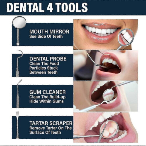 EELHOE 30ml Moldable Teeth Glue 4 Dental Tools Temporary Tooth Filling S 2
