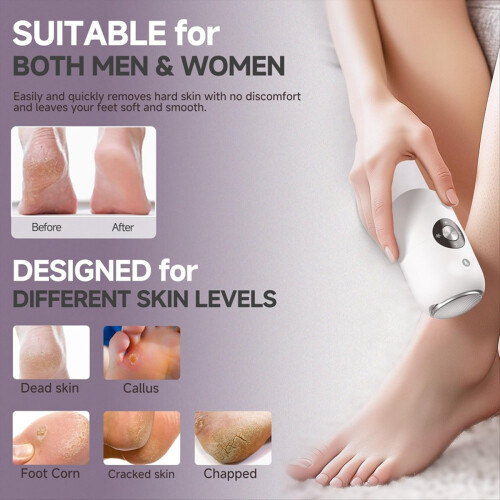 Electric Foot Callus Remover Fully Automatic Foot Grinding Device 1