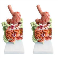 Human Digestive System Model Stomach Anatomy Large Intestine Cecum