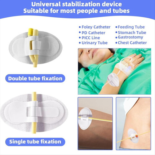 30Pcs Catheter Stabilization Device, Catheter Tube Holder, 2