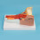 Anatomical Pharyngeal Wall Muscle Model for Disease Study, 7