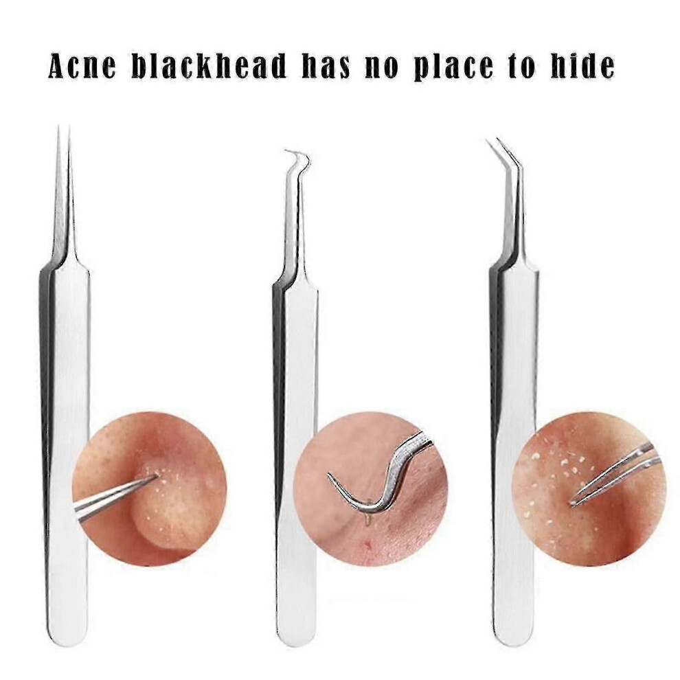 Blackhead and Pimple Tweezers - 3 Types Available - Good