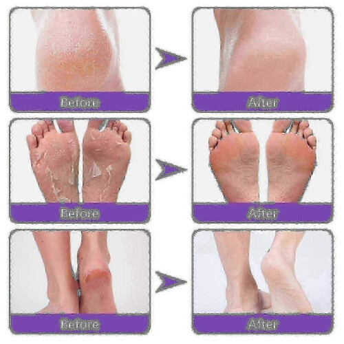Ginger Foot Mask - 2