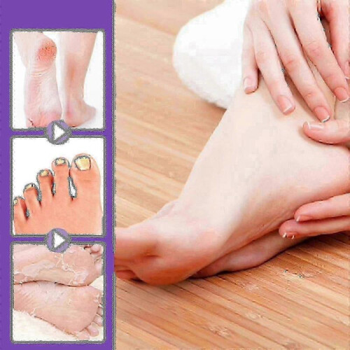 Ginger Foot Mask - 1
