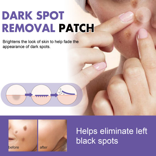 Patchs Éclaircissants pour Taches Brunes du Visage - Teint Uniforme et Lumineux 2