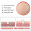 Patchs Correcteurs pour Imperfections - Boutons, Verrues et Cors 6