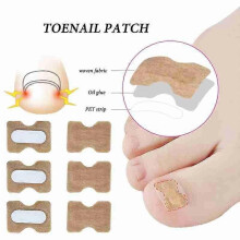 100pcs Ingrown Toenail Corrector Stickers Fingernail Toe Nail Corrector Patch Paronychia Inlays Treatment Care Pedicure Tools