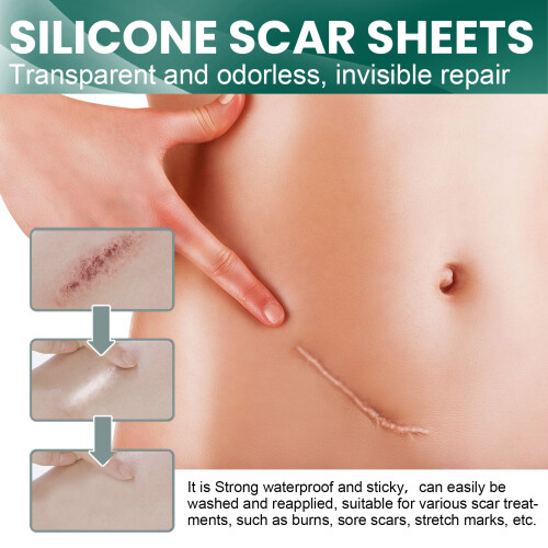 Feuille de Silicone Correctrice pour Cicatrices - Césarienne, Brûlure - Invisible 2