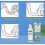 Aligner Foam 60ml, Clean Retainer And Braces, for Care 3