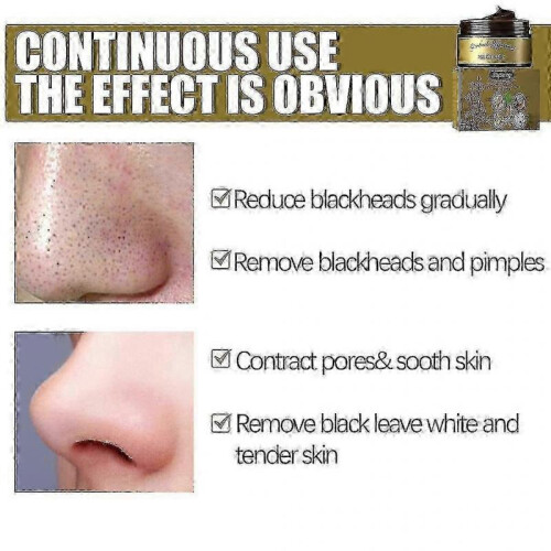 Jaysuing Peel-off Mask Cleansing Removing Blackheads Shrinking Moisturizing | 2