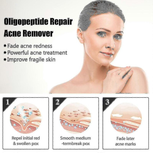 Eelhoe Oligopeptide Repairing And340 2