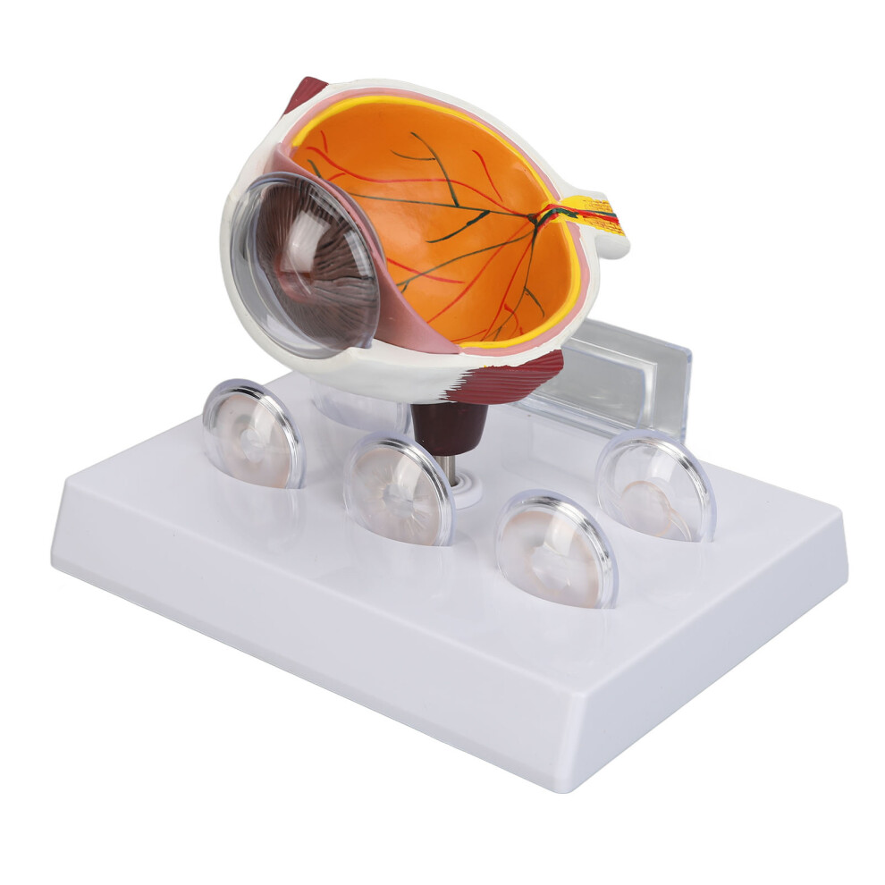 Professional Medical Eye Model for Detailed Anatomical Demonstrations