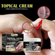 Anti-itch Cream for Sweaty Hands And Feet Dry Itchy Skin Itchy Mosquito Bites Repai