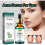 30ml pore shrinking essence, improve skin texture 2