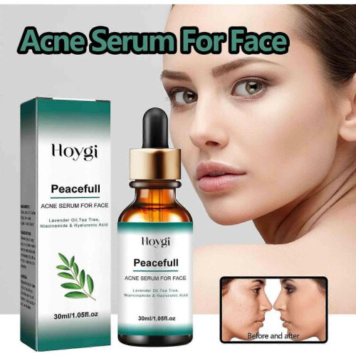 30ml pore shrinking essence, improve skin texture 1