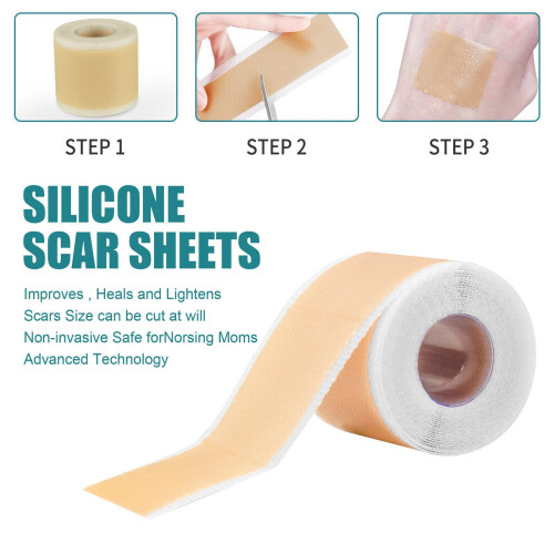Professional Scars Sheets Treatment Tapes for Effective Keloid Wound 2