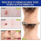 Wart patch skin mole cleaning care remove corns meat thorns warts meat particles 9