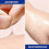 Wart patch skin mole cleaning care remove corns meat thorns warts meat particles 13