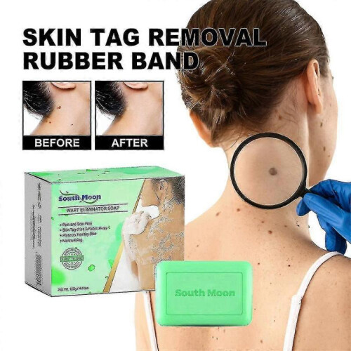 Skin Wart Eliminator Soaps - XSS