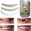 MULTI-SHADE INSTANT Temporary SMILE TEMPORARY REPLACEMENT TEETH KIT 2