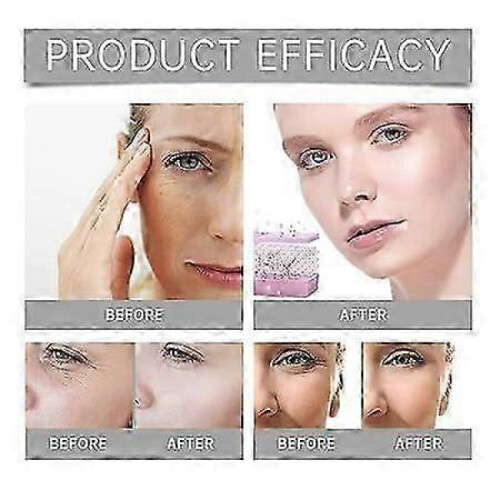 Micro Infusion System for Face, Micro Needling Infusion Kit, Micro Infusion System for Face Taking Care of Blemished Skin 2