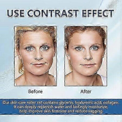Micro Infusion System for Face, Micro Needling Infusion Kit, Micro Infusion System for Face Taking Care of Blemished Skin 1