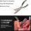 Rib Prep Pro, Edelstahl-Membran-Entferner Zu 5