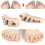 stücke Hallux Valgus Bunion Corrector Unisex 9