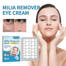 (1box) 144/288/432pcs Milia Remover Patches For Milia Spot Treatment Soften Fat Granule Removal