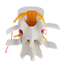 2 Pcs Human Spine Model Lumbar Disc Herniation For School