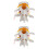 2 Pcs Human Spine Model Lumbar Disc Herniation For School 5