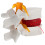 2 Pcs Human Spine Model Lumbar Disc Herniation For School 9