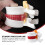 1Pc Human Spine Model Lumbar Disc Herniation For School 7