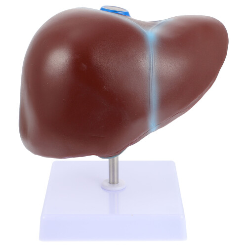 2 Pcs Medical Anatomical Liver Model With Base 1