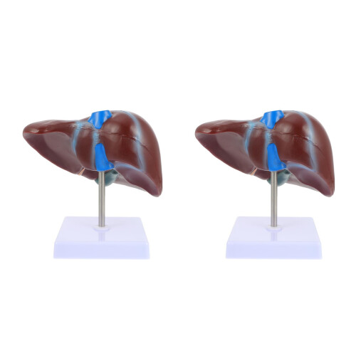 2 Pcs Medical Anatomical Liver Model With Base 2