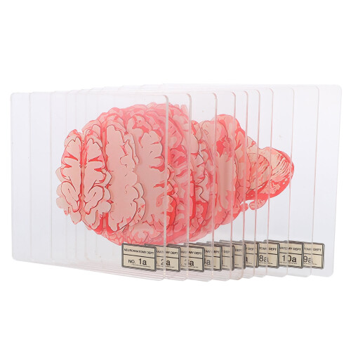 40 Pcs Halloween Blood Spatter Brain Slice Acrylic Coasters 1