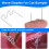 1000Pcs 0.6mm S Wave Staples for Car Bumper Bodywork Plastic Stapler 5