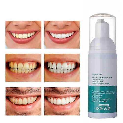 3pcs Teeth Tooth Whitening Toothpaste White Bleaching Dental Whitener Teeth Mousse 1