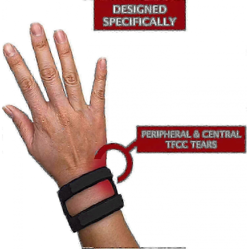 Ρυθμιζόμενος νάρθηκας καρπού Wristwidget για ρήξεις TFCC, ένα μέγεθος που ταιριάζει 1