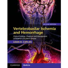 Vertebrobasilar Ischemia and Hemorrhage