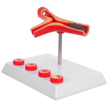 Vascular Model Gefäß Anatomische Modelle Gesundheitsbildung