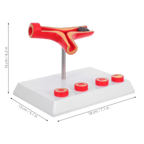 Vascular Model Gefäß Anatomische Modelle Gesundheitsbildung 1