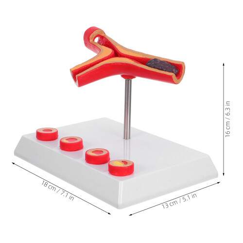 Vascular Model Gefäß Anatomische Modelle Gesundheitsbildung 2