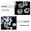 1Pack Aquarium Kies Steine Chips Für Fischtanks 7