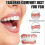 (2pcs) Denture Silicone Lining Silicone Fit Denture Silicone Reline Kit Denture Prosthesis Complete Denture Suitable For Silicone Dentures 3