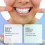 (2pcs) Denture Silicone Lining Silicone Fit Denture Silicone Reline Kit Denture Prosthesis Complete Denture Suitable For Silicone Dentures 2