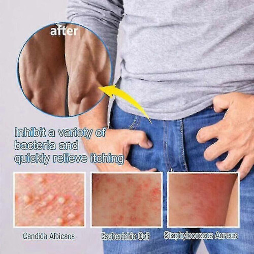 2x Men Intimate Cream 20g for Men Balanitis Itching Relief 1