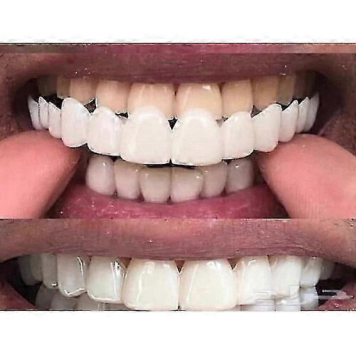 (Lower teeth) Upper/lower Comfort Fit Flex Whitening Denture Braces -CN New 2