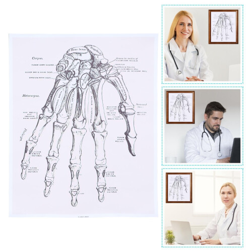 1St Anatomische Chart Hand Met Duidelijke Voor 1