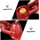 Walnut Opener Nutcracker Tool Comfortable Grip For Arthritis Hands, Easy To Use, Multi-Function Nut Clip For Kitchen 4